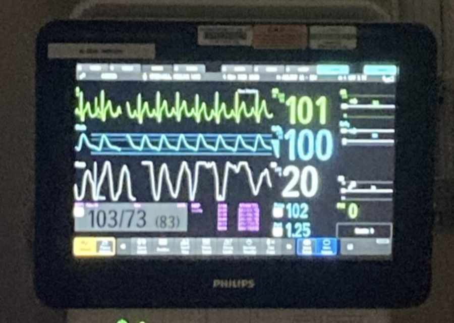 Machines+monitor+Aster%E2%80%99s+vitals+after+the+surgery.+